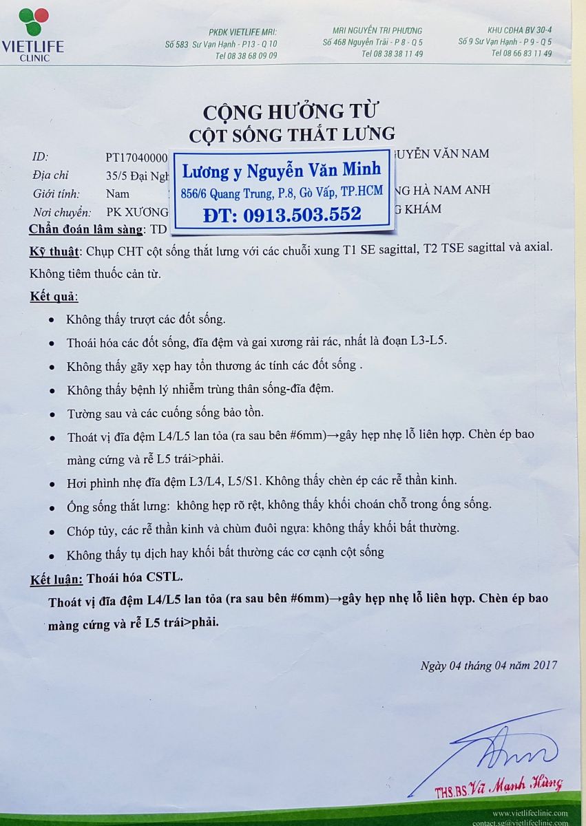 Chụp cộng hưởng từ cột sống thắt lưng